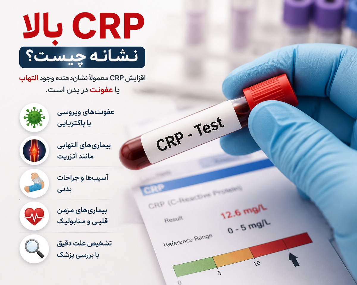 CRP بالا نشانه چیست؟ بررسی علت افزایش پروتئین واکنشی C و زمان مراجعه به پزشک